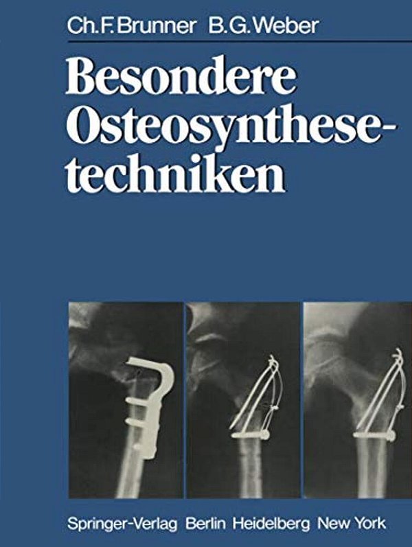 Besondere Osteosynthesetechniken-..