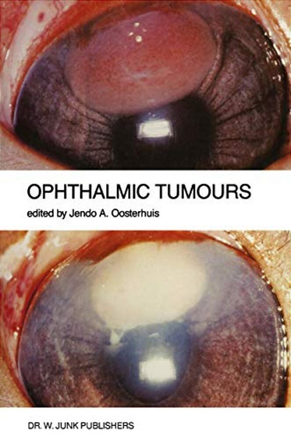Ophthalmic Tumours: Including Lectures Presented At The Boerhaave Course On "Ophthalmic Tumours" Of The Leiden Medical Faculty, Held In Leiden, The Ne-..