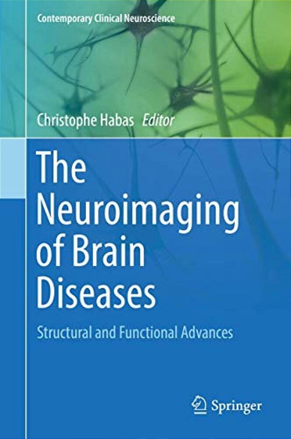 The Neuroimaging Of Brain Diseases: Structural And Functional Advances-..