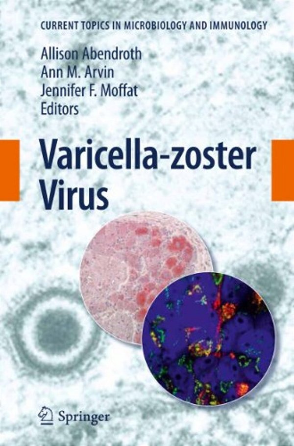 Varicella-Zoster Virus-..