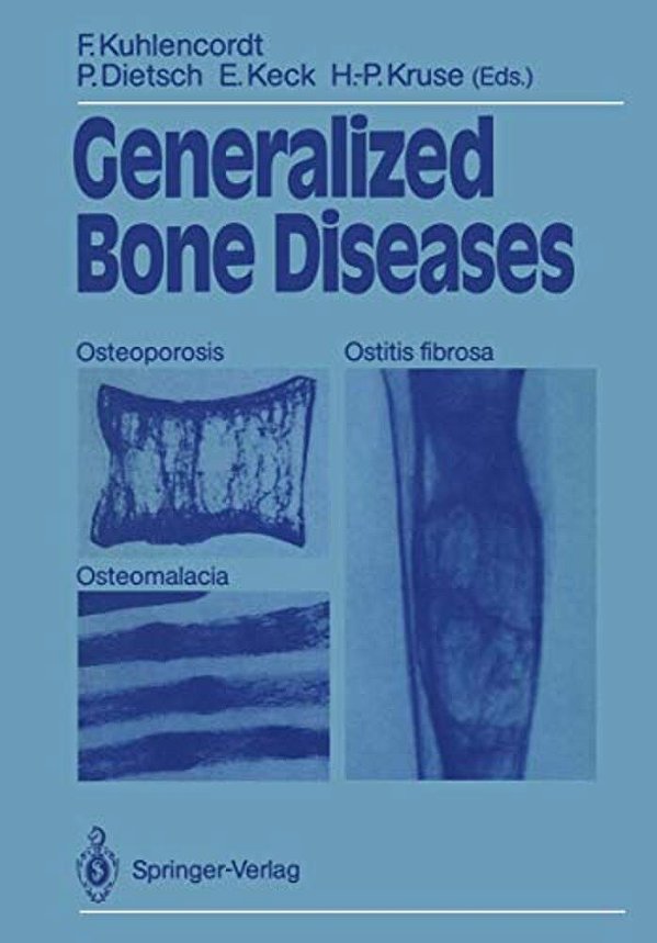 Generalized Bone Diseases: Osteoporosis Osteomalacia Ostitis Fibrosa-..