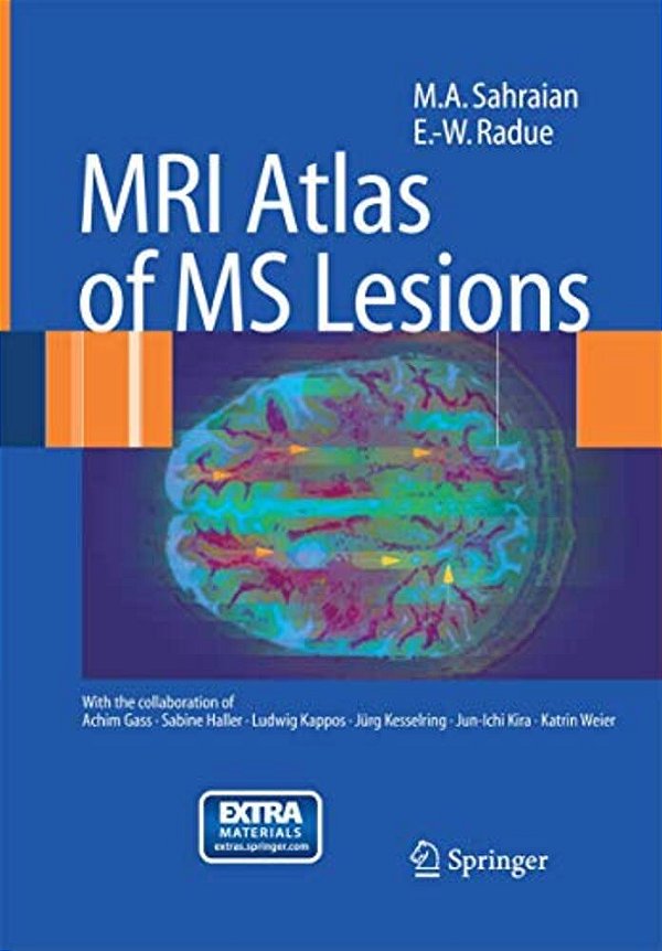 Mri Atlas Of Ms Lesions-..