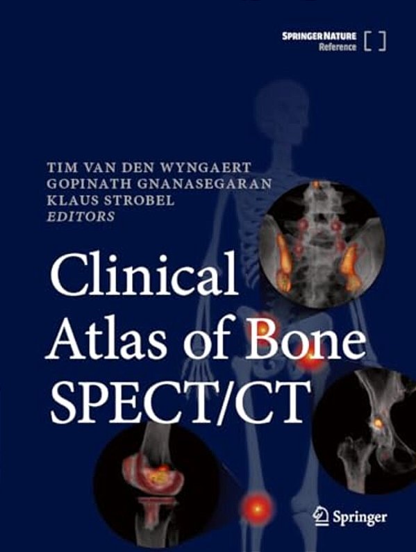 Clinical Atlas Of Bone Spect/Ct-..