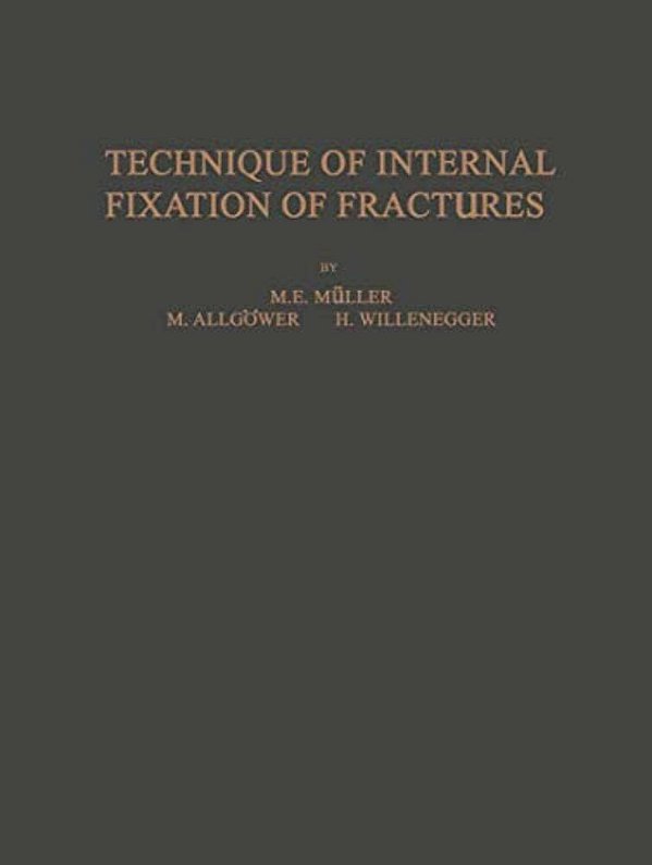 Technique Of Internal Fixation Of Fractures-..