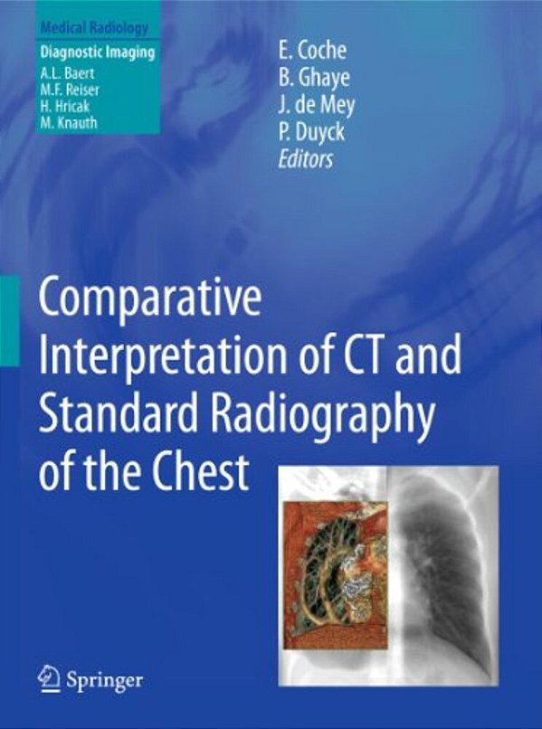 Comparative Interpretation Of Ct And Standard Radiography Of The Chest-..