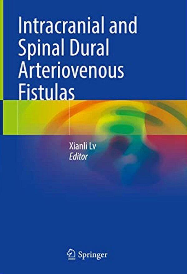 Intracranial And Spinal Dural Arteriovenous Fistulas-..