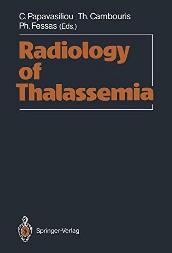 Radiology Of Thalassemia-..