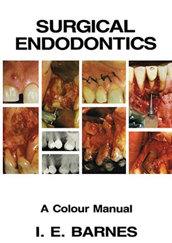 Surgical Endodontics: A Colour Manual-..