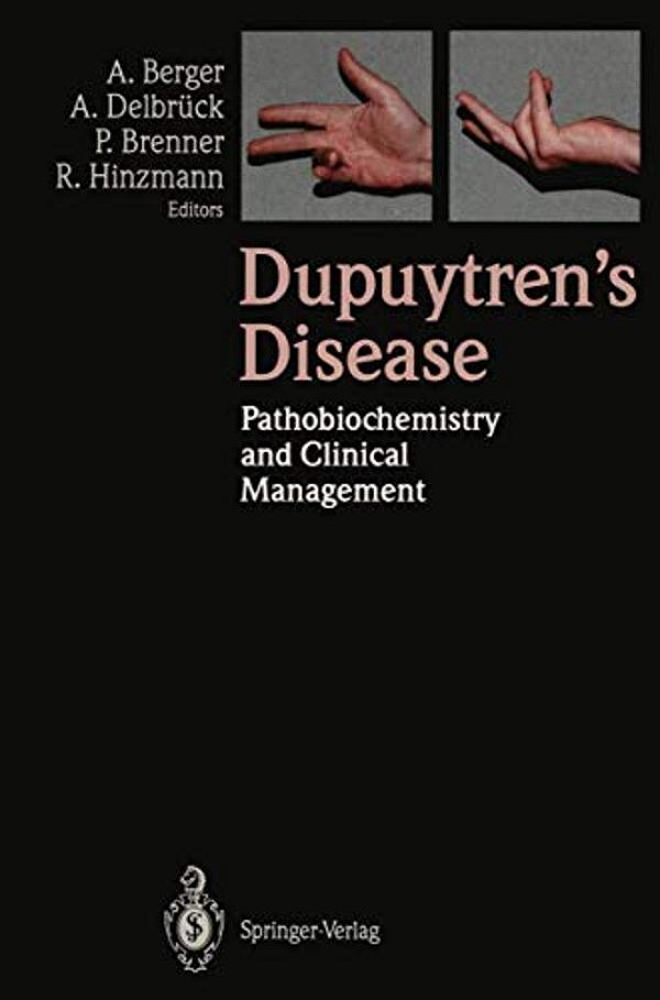 Dupuytren's Disease: Pathobiochemistry And Clinical Management-..