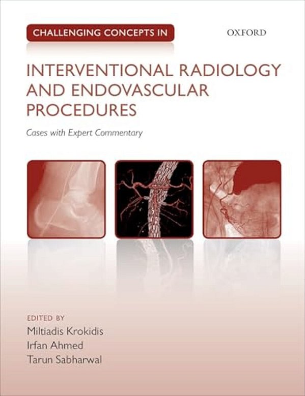 Challenging Concepts In Interventional Radiology-..