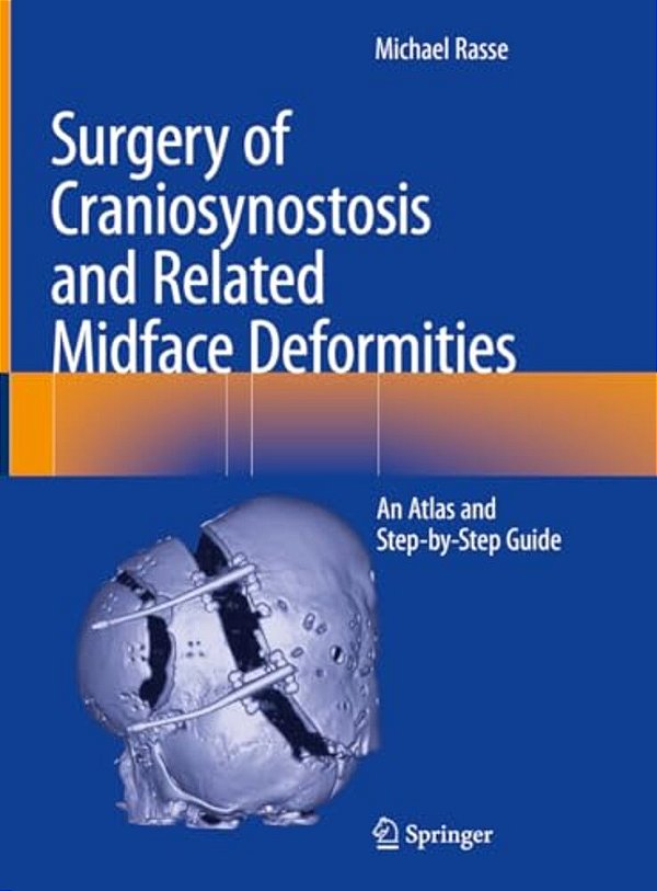 Surgery Of Craniosynostosis And Related Midface Deformities: An Atlas And Step-By-step Guide-..