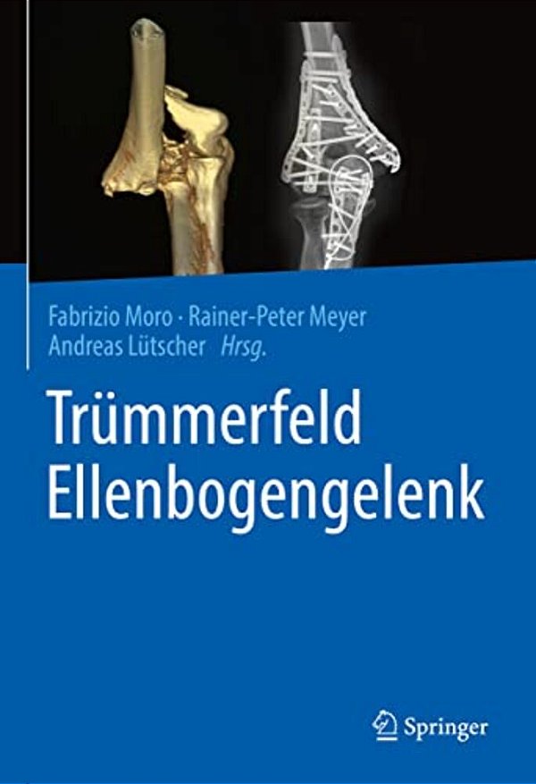 Trümmerfeld Ellenbogengelenk-..