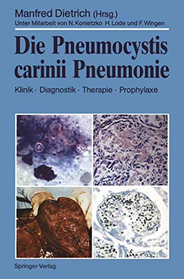 Die Pneumocystis Carinii Pneumonie: Klinik - Diagnostik - Therapie - Prophylaxe-..