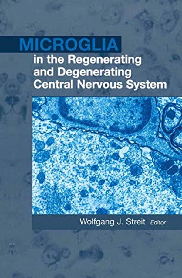 Microglia In The Regenerating And Degenerating Central Nervous System-..