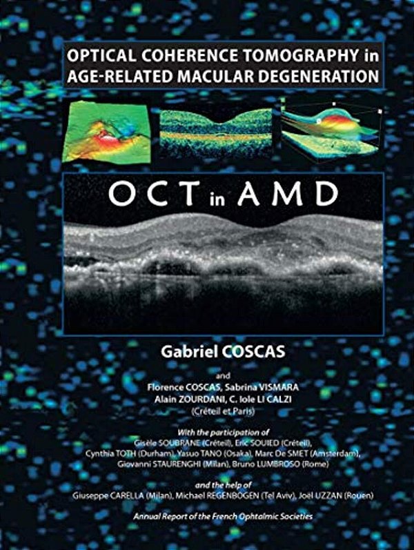 Optical Coherence Tomography In Age-Related Macular Degeneration-..