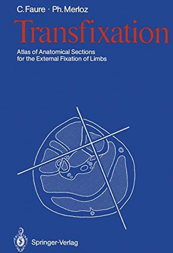 Transfixation: Atlas Of Anatomical Sections For The External Fixation Of Limbs-..