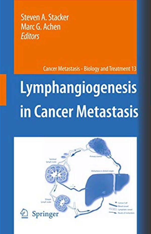 Lymphangiogenesis In Cancer Metastasis-..