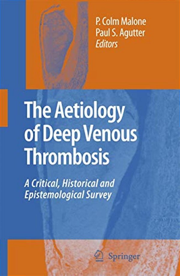 The Aetiology Of Deep Venous Thrombosis: A Critical, Historical And Epistemological Survey-..