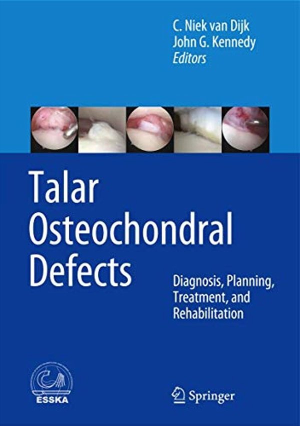 Talar Osteochondral Defects: Diagnosis, Planning, Treatment, And Rehabilitation-..