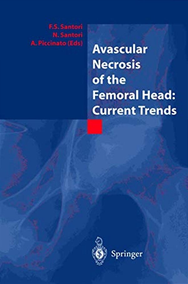 Avascular Necrosis Of The Femoral Head: Current Trends: Current Trends-..