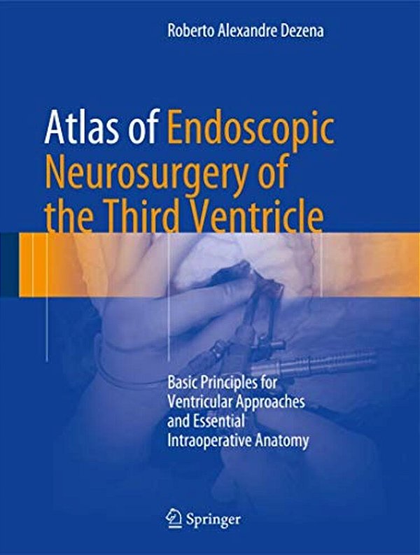 Atlas Of Endoscopic Neurosurgery Of The Third Ventricle: Basic Principles For Ventricular Approaches And Essential Intraoperative Anatomy-..