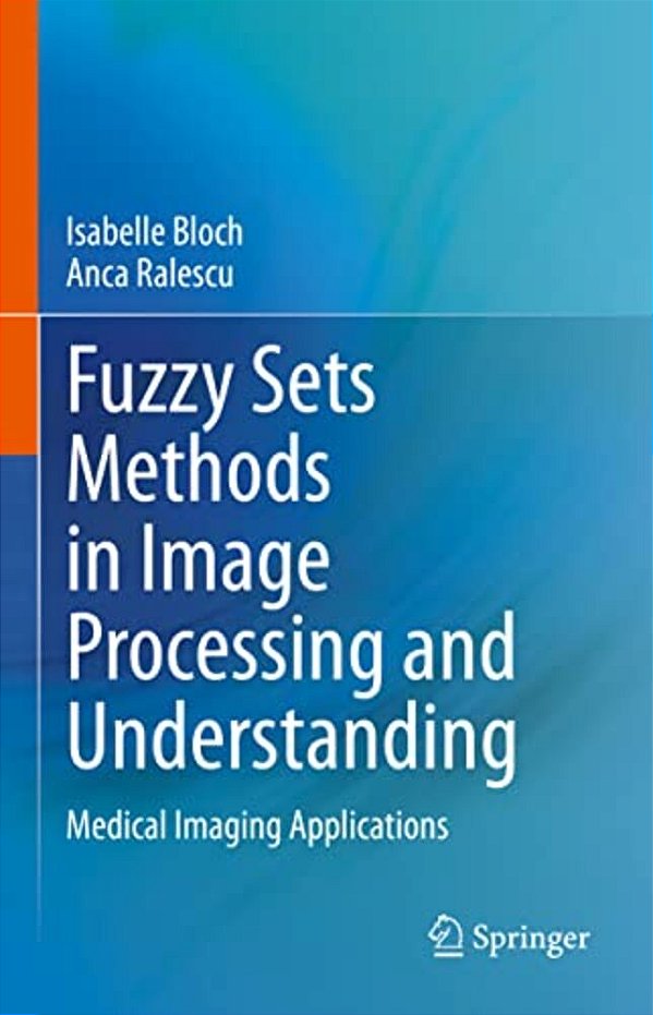 Fuzzy Sets Methods In Image Processing And Understanding: Medical Imaging Applications-..
