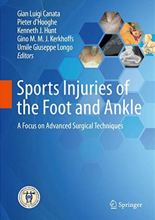 Sports Injuries Of The Foot And Ankle: A Focus On Advanced Surgical Techniques-..