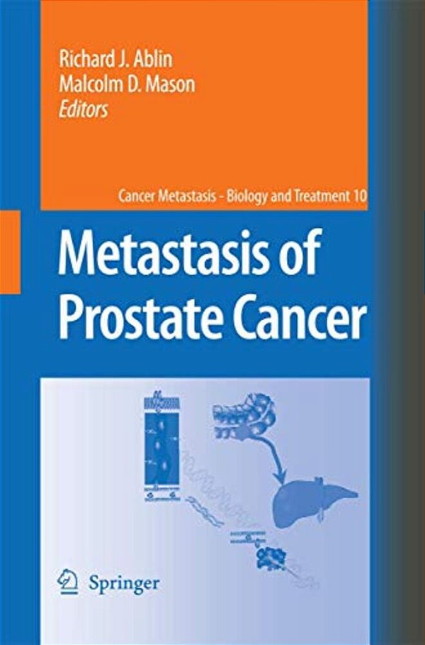 Metastasis Of Prostate Cancer-..