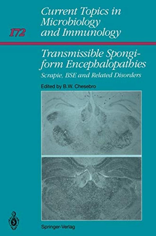 Transmissible Spongiform Encephalopathies:: Scrapie, Bse And Related Human Disorders-..