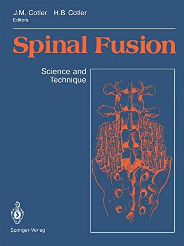 Spinal Fusion: Science And Technique-..