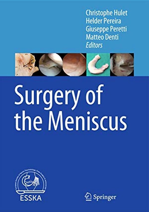 Surgery Of The Meniscus-..