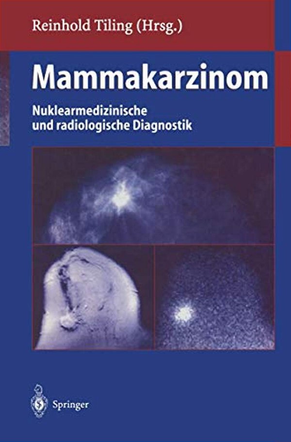 Mammakarzinom: Nuklearmedizinische Und Radiologische Diagnostik-..