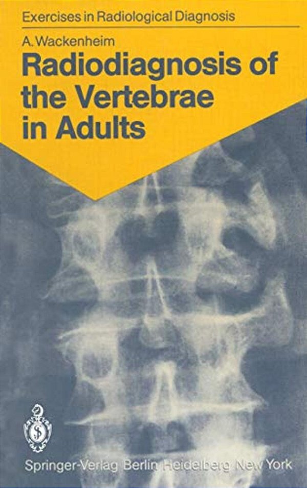 Radiodiagnosis Of The Vertebrae In Adults: 125 Exercises For Students And Practitioners-..