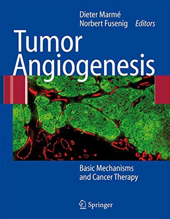 Tumor Angiogenesis: Basic Mechanisms And Cancer Therapy-..