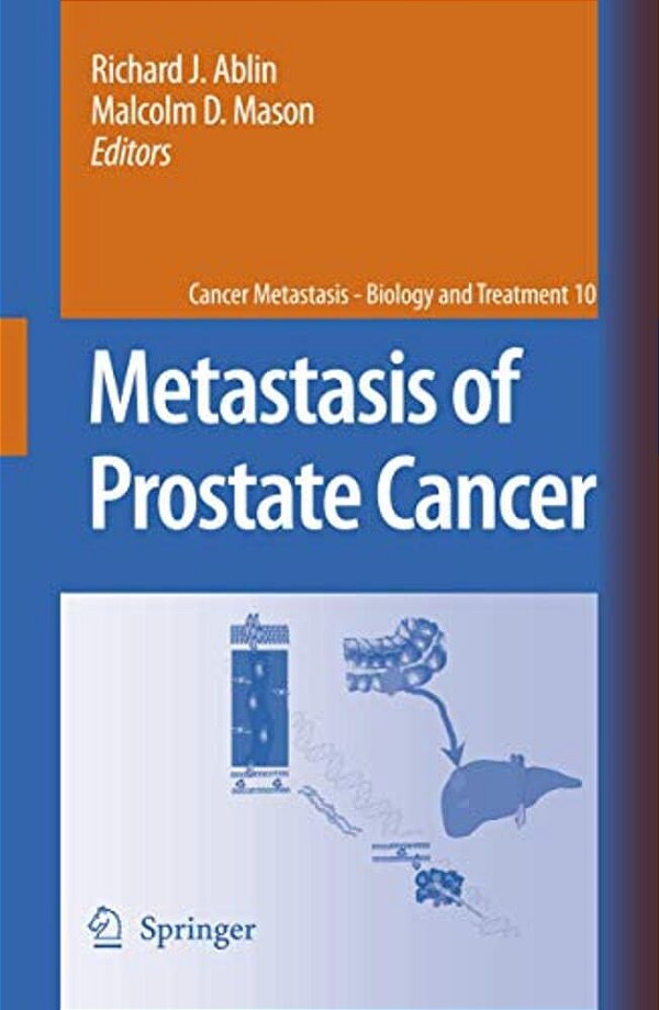 Metastasis Of Prostate Cancer-..