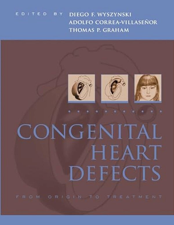 Congenital Heart Defects: From Origin To Treatment-..