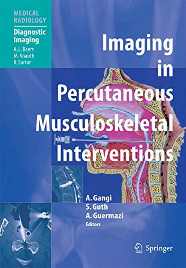Imaging In Percutaneous Musculoskeletal Interventions-..