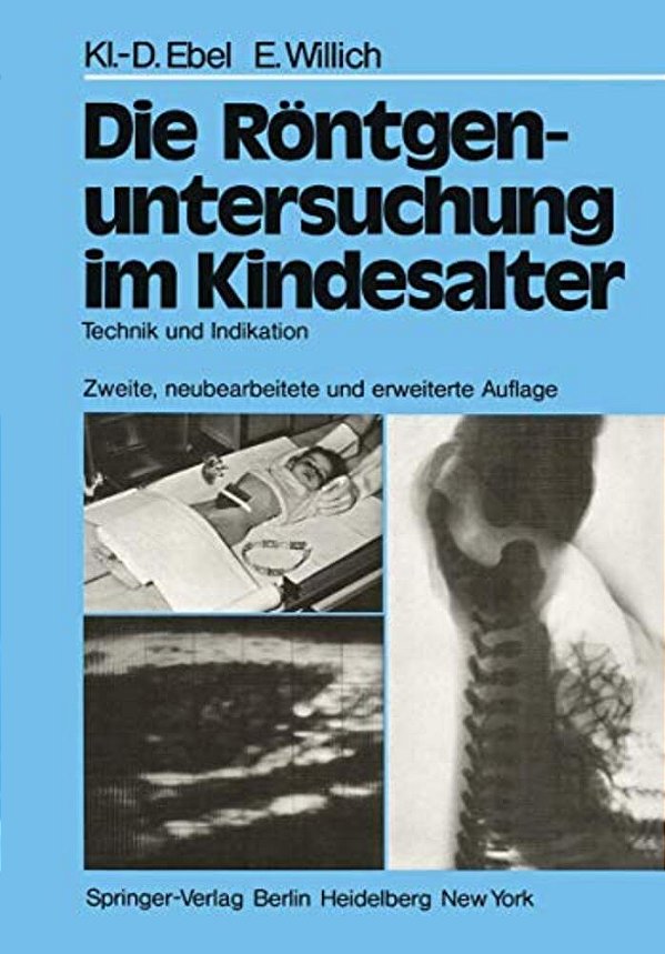 Die Röntgenuntersuchung Im Kindesalter: Technik Und Indikation-..