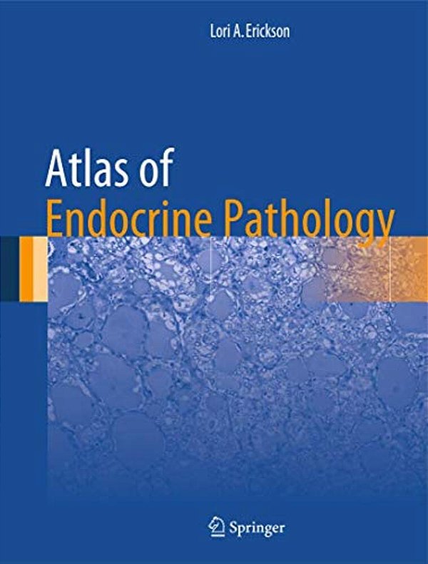Atlas Of Endocrine Pathology-..