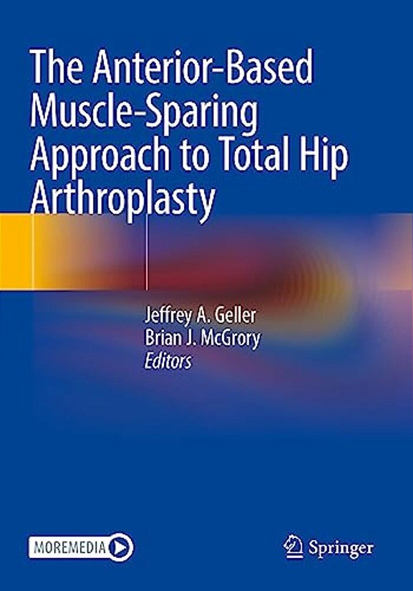 The Anterior-Based Muscle-Sparing Approach To Total Hip Arthroplasty-..