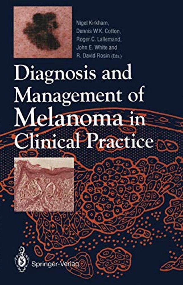 Diagnosis And Management Of Melanoma In Clinical Practice-..