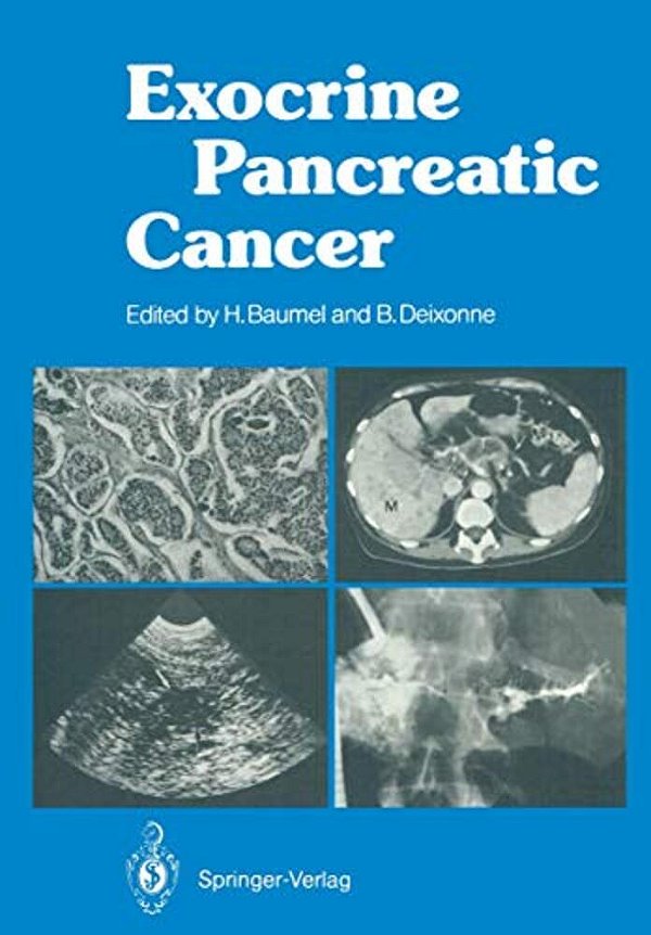 Exocrine Pancreatic Cancer-..
