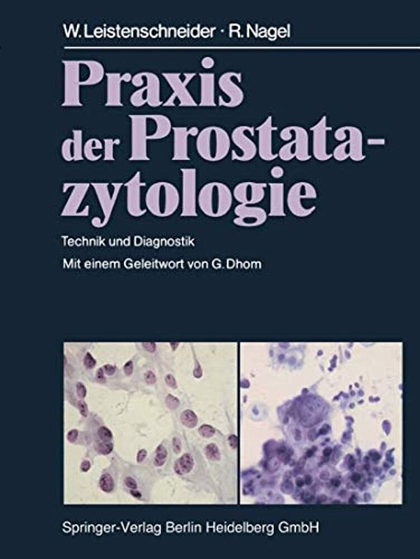 Praxis Der Prostatazytologie: Technik Und Diagnostik-..