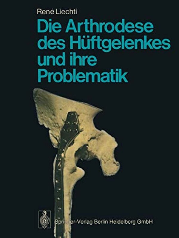 Die Arthrodese Des Hüftgelenkes Und Ihre Problematik-..
