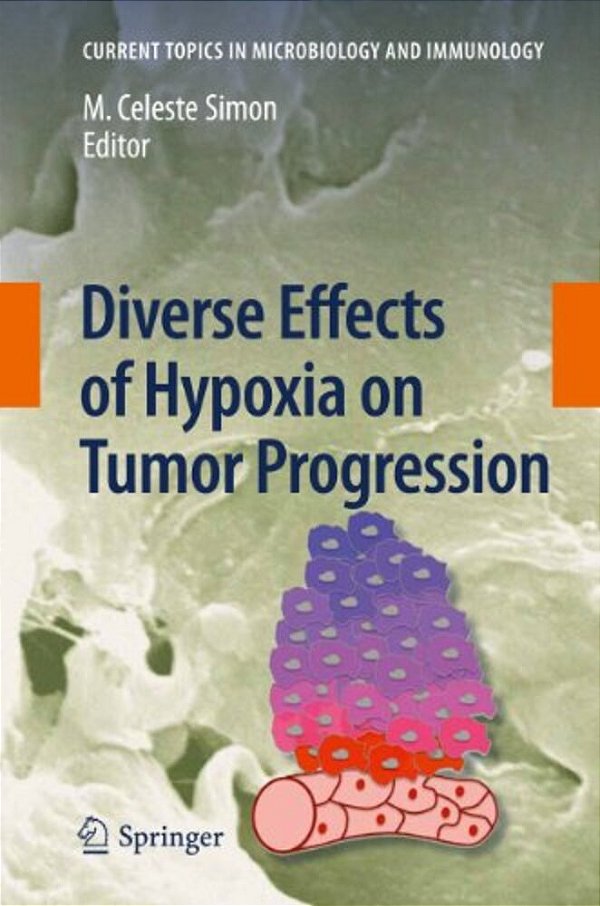 Diverse Effects Of Hypoxia On Tumor Progression-..