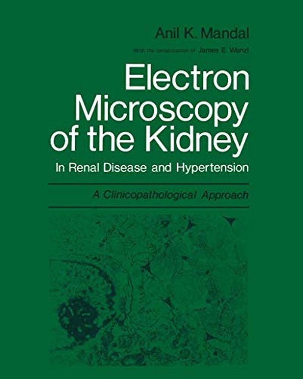 Electron Microscopy Of The Kidney: In Renal Disease And Hypertension: A Clinicopathological Approach-..