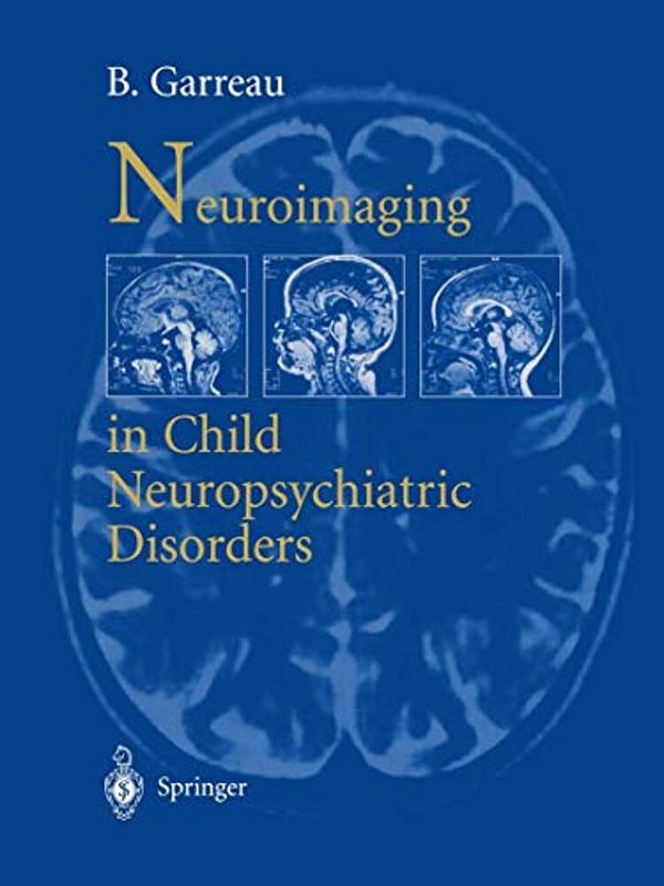 Neuroimaging In Child Neuropsychiatric Disorders-..