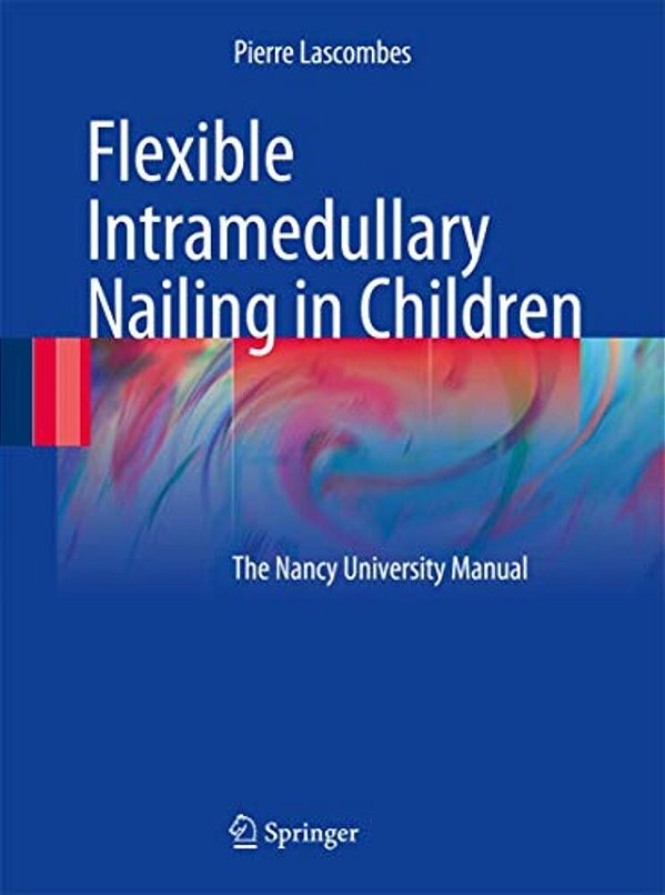 Flexible Intramedullary Nailing In Children: The Nancy University Manual-..