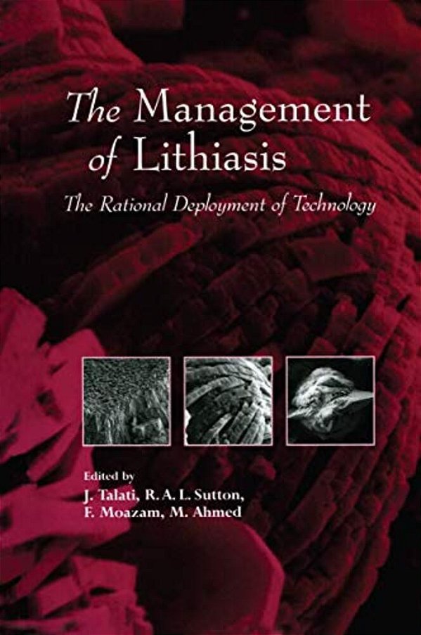 The Management Of Lithiasis: The Rational Deployment Of Technology-..