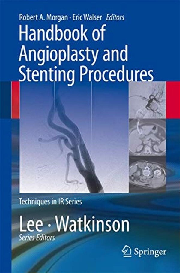 Handbook Of Angioplasty And Stenting Procedures-..
